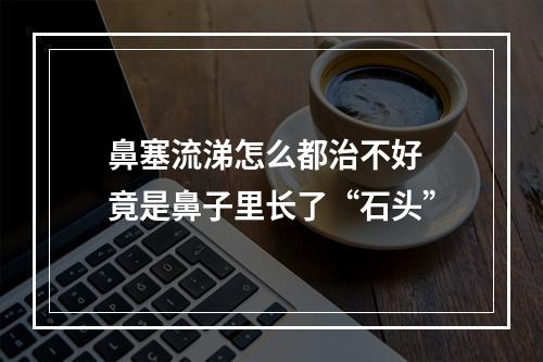 鼻塞流涕怎么都治不好 竟是鼻子里长了“石头”