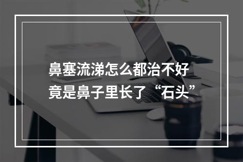 鼻塞流涕怎么都治不好 竟是鼻子里长了“石头”