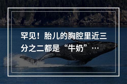 罕见！胎儿的胸腔里近三分之二都是“牛奶”…