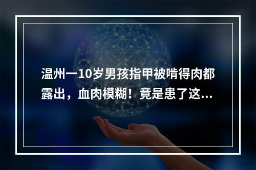 温州一10岁男孩指甲被啃得肉都露出，血肉模糊！竟是患了这种病…