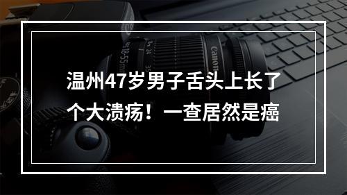 温州47岁男子舌头上长了个大溃疡！一查居然是癌