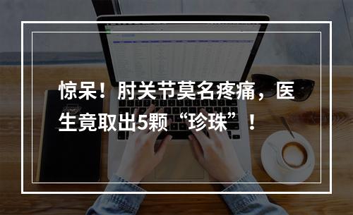 惊呆！肘关节莫名疼痛，医生竟取出5颗“珍珠”！
