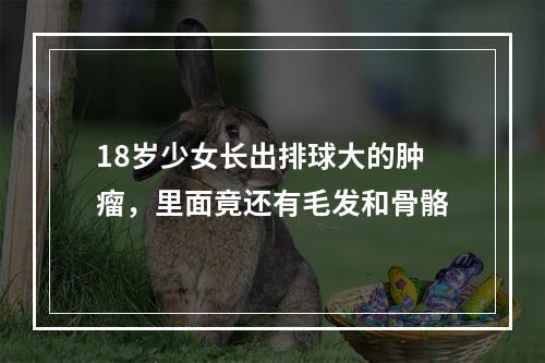 18岁少女长出排球大的肿瘤，里面竟还有毛发和骨骼