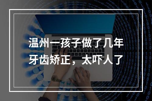 温州一孩子做了几年牙齿矫正，太吓人了