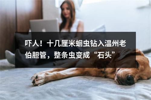 吓人！十几厘米蛔虫钻入温州老伯胆管，整条虫变成“石头”