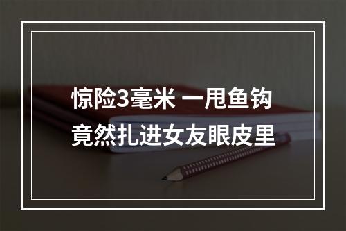 惊险3毫米 一甩鱼钩竟然扎进女友眼皮里
