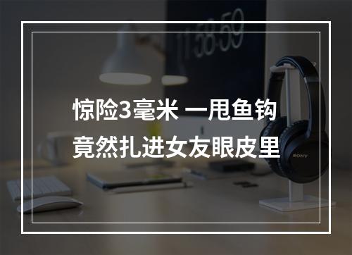 惊险3毫米 一甩鱼钩竟然扎进女友眼皮里