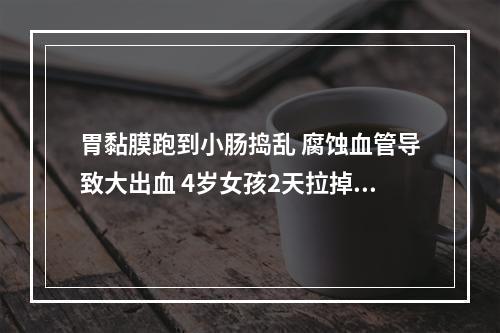 胃黏膜跑到小肠捣乱 腐蚀血管导致大出血 4岁女孩2天拉掉全身“一半血液”
