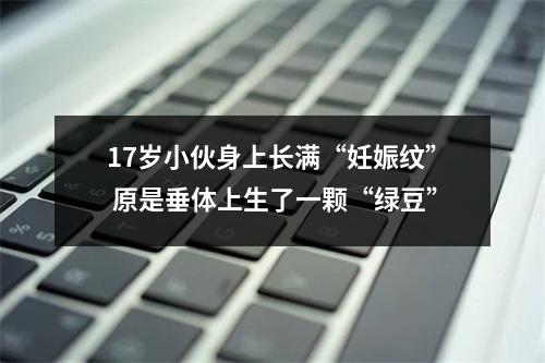 17岁小伙身上长满“妊娠纹” 原是垂体上生了一颗“绿豆”