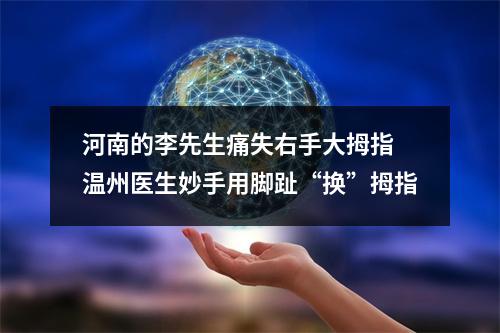 河南的李先生痛失右手大拇指 温州医生妙手用脚趾“换”拇指