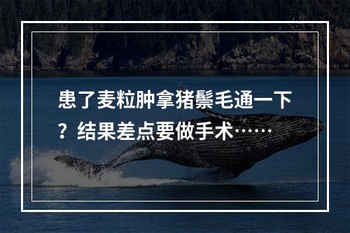 患了麦粒肿拿猪鬃毛通一下？结果差点要做手术……