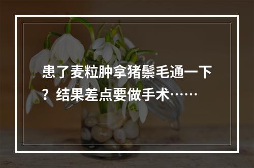 患了麦粒肿拿猪鬃毛通一下？结果差点要做手术……