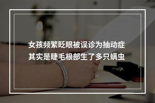 女孩频繁眨眼被误诊为抽动症 其实是睫毛根部生了多只螨虫