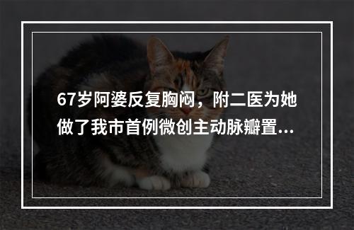 67岁阿婆反复胸闷，附二医为她做了我市首例微创主动脉瓣置入术
