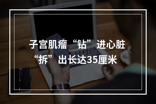 子宫肌瘤“钻”进心脏 “拆”出长达35厘米