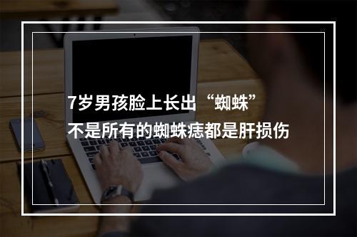 7岁男孩脸上长出“蜘蛛” 不是所有的蜘蛛痣都是肝损伤