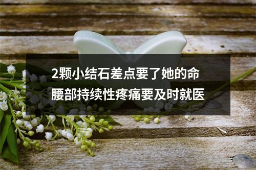 2颗小结石差点要了她的命 腰部持续性疼痛要及时就医