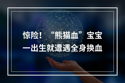 惊险！“熊猫血”宝宝一出生就遭遇全身换血