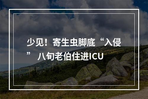 少见！寄生虫脚底“入侵” 八旬老伯住进ICU