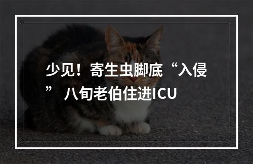 少见！寄生虫脚底“入侵” 八旬老伯住进ICU