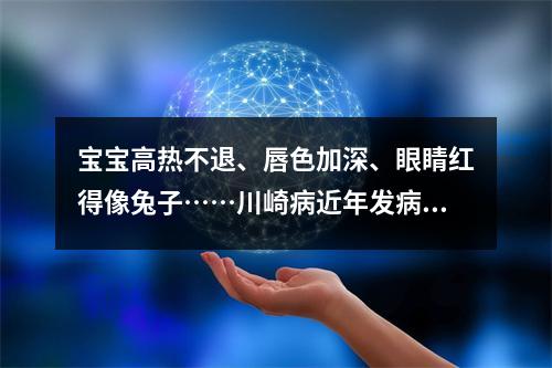 宝宝高热不退、唇色加深、眼睛红得像兔子……川崎病近年发病率明显上升