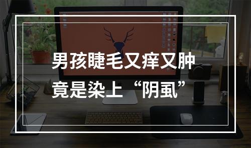 男孩睫毛又痒又肿 竟是染上“阴虱”