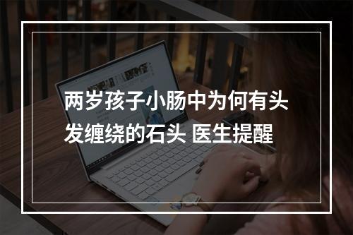 两岁孩子小肠中为何有头发缠绕的石头 医生提醒