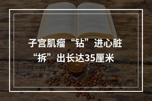 子宫肌瘤“钻”进心脏 “拆”出长达35厘米