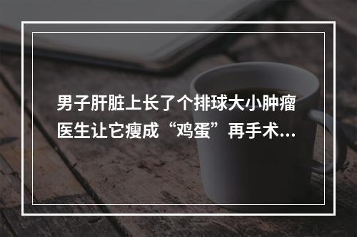 男子肝脏上长了个排球大小肿瘤 医生让它瘦成“鸡蛋”再手术摘除