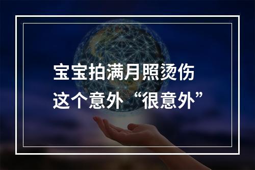 宝宝拍满月照烫伤 这个意外“很意外”