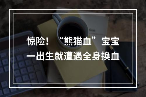 惊险！“熊猫血”宝宝一出生就遭遇全身换血