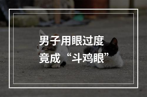 男子用眼过度 竟成“斗鸡眼”