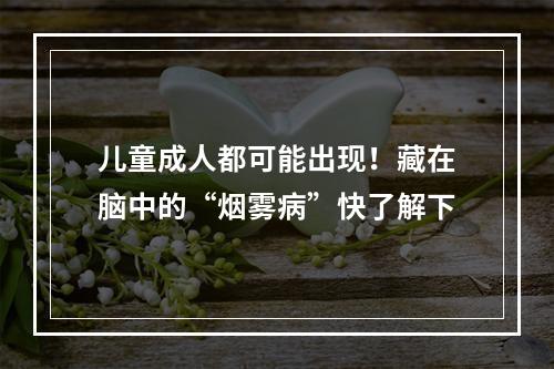 儿童成人都可能出现！藏在脑中的“烟雾病”快了解下