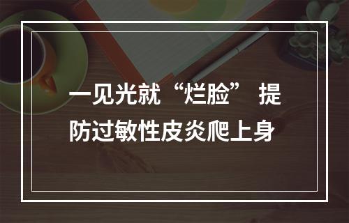 一见光就“烂脸” 提防过敏性皮炎爬上身